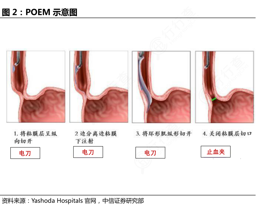 想问下各位网友POEM示意图是怎样的呢_行行查_行业研究数据库